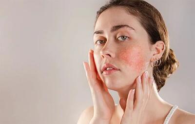 چگونه از پوست حساس مراقبت کنیم؟