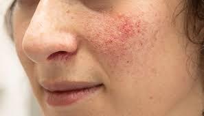 چه علائمی در پوست نگران کننده است؟