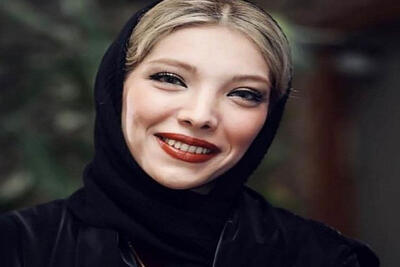 نگاه روز | تغییر چهره صدف اسپهبدی « عروس فیلم هتل » همه را شگفت‌زده کرد!