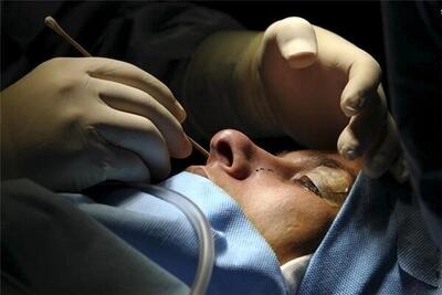 جراح زیبایی قلابی با سابقه فحشا و حمل سلاح، این‌بار قاتل شد/ جزییات ماجرا را بخوانید