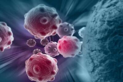 راهکارهای واکسیناسیون HPV در مناطق پرخطر ایران