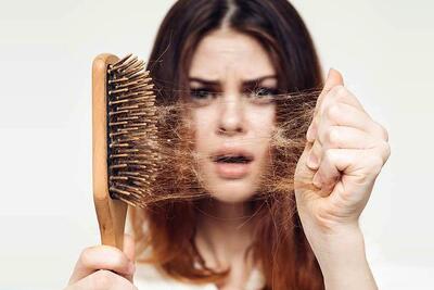 چرا به ریزش سکه‌ای مو مبتلا می‌شویم؟