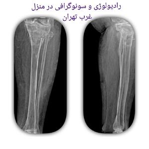 رادیولوژی در منزل، سونوگرافی در منزل الو رادیولوژی