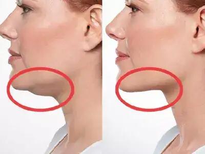 بدون جراحی غبغب صورتت رو از بین ببر+فیلم