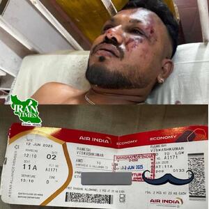 عکس/ تنها بازمانده سقوط هواپیما در هند