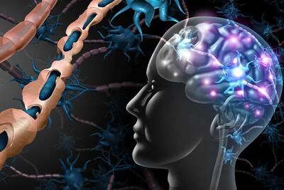 تعداد بیماران مبتلا به ام اس در استان اصفهان در سه دهه گذشته بیش از ۲۵۰ برابر شده