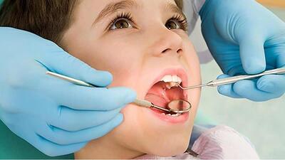 تولید ۳۰ محصول دندانپزشکی پیشرفته از سوی محققان ایرانی - شهروند آنلاین
