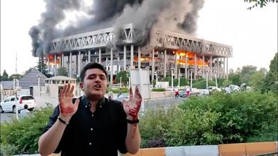 یونس شادلو با دست خونین، از ساختمان شیشه ای صداسیما گزارش می دهد