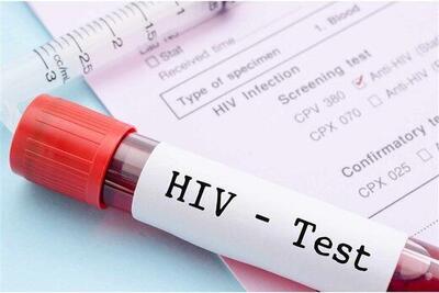ویروس HIV دیگر نمی‌تواند پنهان شود
