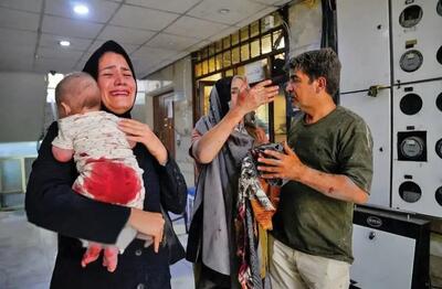 As Israel’s bombs kills some infants, the shock and the stress also takes the lives of others
