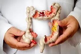 برای خلاصی از  یبوست  این خوراکی ها را بخورید!