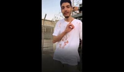 اسیر فلسطینی پس از آزادی از شرایط سخت زندان‌های اسرائیل می‌گوید (فیلم)