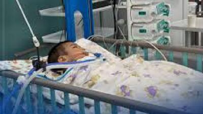 وضعیت کودک افغانستانی رو به بهبودی گذاشت