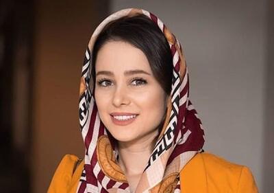 نگاه روز | چهره باورنکردنی الناز حبیبی قبل و بعد از جراحی های زیبایی