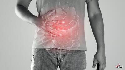 افزایش تقریباً دوبرابری سندرم روده تحریک‌پذیر (IBS) در دوران پاندمی