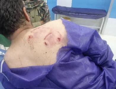 خرس به یک جوان کشاورز جیرفتی حمله کرد