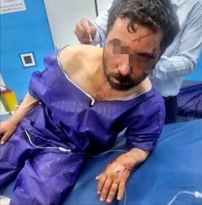 حمله خرس به دامدار جیرفتی