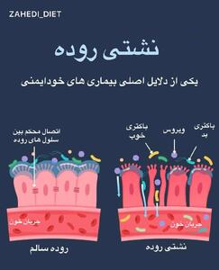 اختلال روده ی نشت کننده و بیماریهای خودایمنی - سبک ایده آل