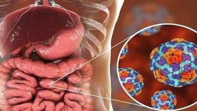 آخرین وضعیت شیوع برخی بیماری‌های تنفسی در کشور