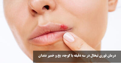 درمان فوری تبخال در سه دقیقه با گوجه، یخ و خمیر دندان | رفع خانگی تبخال در سه دقیقه