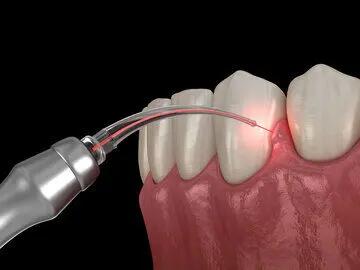 استرس بر سلامت دهان و دندان چه تاثیری دارد؟