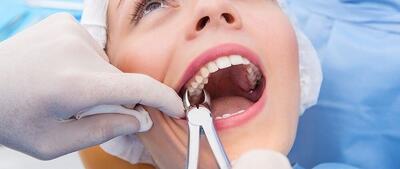 آیا استرس بر سلامت دهان و دندان تاثیر دارد؟ ؛ چه کار کنیم ؟