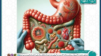ارزیابی جمعیت باکتری‌ها در بیماران مبتلا به گاستریت و آتروفی معده