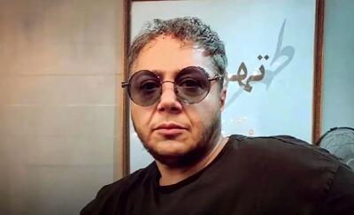 تغییر چهره باورنکردنی مازیار لرستانی بعد از زاویه سازی فک | عمل زیبایی چهره مازیار لرستانی را از این رو به اون رو کرد + ویدئو