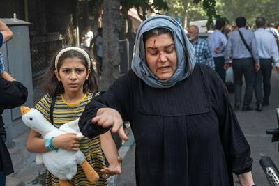 معاون وزارت بهداشت: ۵۷۵۰ نفر در تجاوز رژیم صهیونیستی به کشور مجروح شدند؛ ۱۷۰ نفر از مجروحان همچنان در بیمارستان‌ها بستری هستند