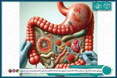 ارزیابی جمعیت باکتری‌ها در بیماران مبتلا به گاستریت و آتروفی معده 