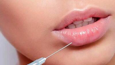 ترند لب‌های برجسته و زیبایی دیجیتال چگونه هویت را تغییر می‌دهد؟