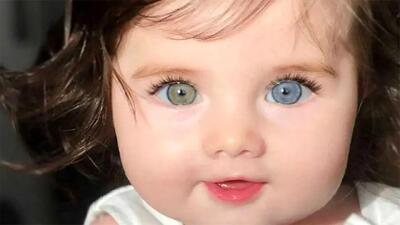 چرا چشم‌های برخی از افراد دو رنگ است؟