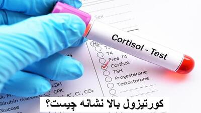کورتیزول بالا نشانه چیست؟ علائم کورتیزول بالا در مردان و زنان + درمان آن