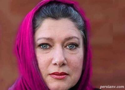 نگاه روز | تصویر باورنکردنی از چهره جدید فریبا متخصص که خیلی جوان تر شده