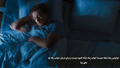 خوابیدن زیاد نشانه چیست؟ از کمبود چیست و برای درمان خواب زیاد چه بخوریم؟