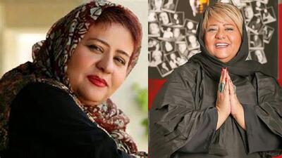 تصویر روز | تغییر چهره زیبای رابعه اسکویی | گلی شی