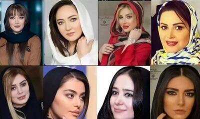 قبل و بعد عمل زیبایی بازیگران زن