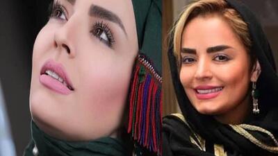 تصویر روز | سپیده خداوردی با پوششی از رنگ های شاد | گلی شی