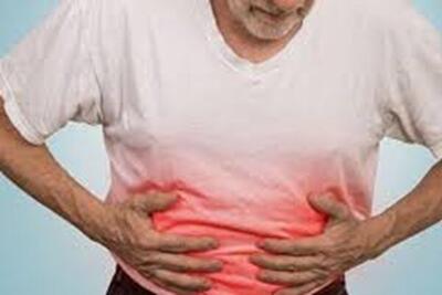 افزایش موارد سرطان آپاندیس در نسل جدید