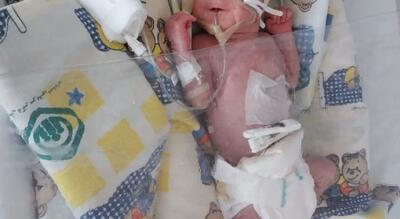 معجزه‌ای کوچک در بخش NICU بیمارستان شریعتی اصفهان