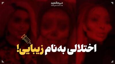 اختلالی به نام زیبایی! | صورت‌هایی که «کافی» به نظر نمی‌رسند