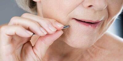 مو‌های زائد چانه نشانه چیست؟