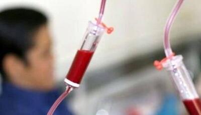 نکاتی جالب درباره این بیماری خونی و ژنتیکی