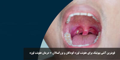 قویترین آنتی بیوتیک برای عفونت لوزه کودکان و بزرگسالان + درمان عفونت لوزه در بزرگسالان