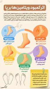 اینفوتابناک | اثر کمبود ویتامین‌ها بر پاها