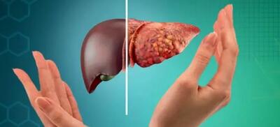 پاکسازی کبد با این گیاه ترش مزه