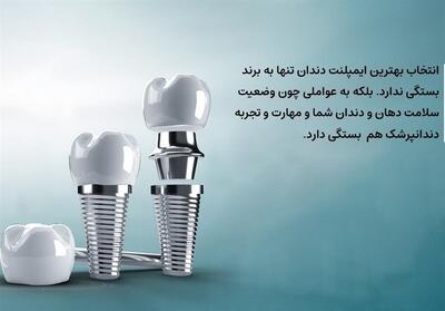بهترین برندهای ایمپلنت دندان در ایران از نگاه متخصصان - تسنیم