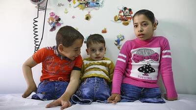 هر روز ۱۰ کودک فلسطینی پاهای خود را از دست می دهند