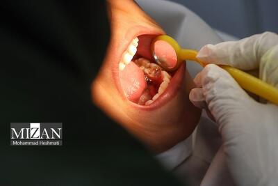 خدمات تحت پوشش بیمه سلامت در حوزه دندان‌پزشکی و فیزیوتراپی را بشناسید