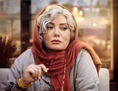 بوتاکس و تزریق ژل نگار فروزنده را زیبا‌تر کرد